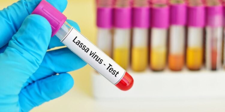 Fièvre de Lassa